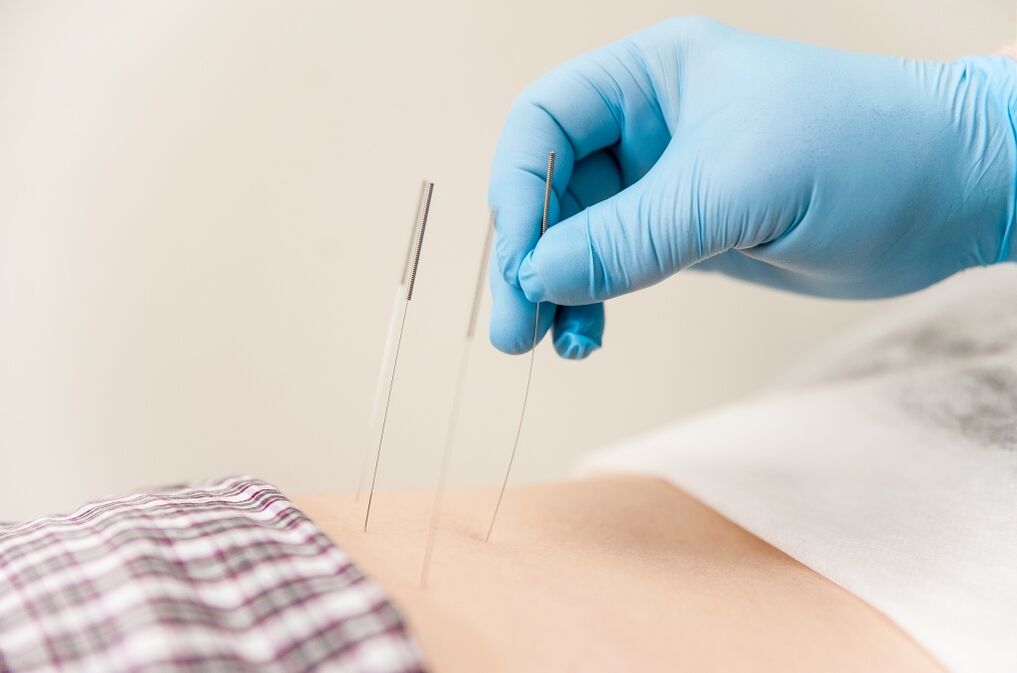 Terciferation of thoracic osteocondrosis