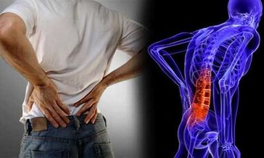 Reasons for the development of lomber osteocondrosis