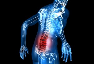 What is osteochondrosis of the lumbar spine